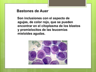 Son inclusiones con el aspecto de
agujas, de color rojo, que se pueden
encontrar en el citoplasma de los blastos
y promielocitos de las leucemias
mieloides agudas.
Bastones de Auer
 