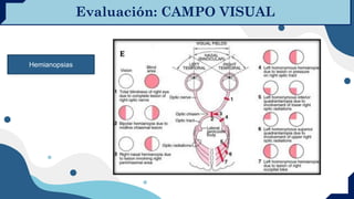 SEMINARIO 2. HC-EXAMEN-CAMPO-VISUAL.pdf