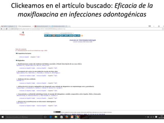 Clickeamos en el artículo buscado: Eficacia de la
moxifloxacina en infecciones odontogénicas
 