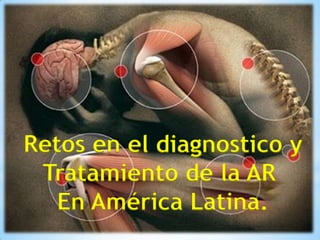 Retos en el diagnostico y
Tratamiento de la AR
En América Latina.
 