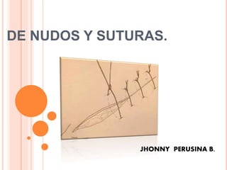 DE NUDOS Y SUTURAS.
JHONNY PERUSINA B.
 
