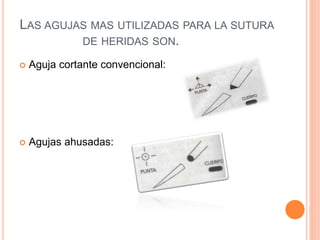 LAS AGUJAS MAS UTILIZADAS PARA LA SUTURA
DE HERIDAS SON.
 Aguja cortante convencional:
 Agujas ahusadas:
 