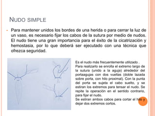  Para mantener unidos los bordes de una herida o para cerrar la luz de
un vaso, es necesario fijar los cabos de la sutura por medio de nudos.
El nudo tiene una gran importancia para el éxito de la cicatrización y
hemostasia, por lo que deberá ser ejecutado con una técnica que
ofrezca seguridad.
Es el nudo más frecuentemente utilizado .
Para realizarlo se enrolla el extremo largo de
la sutura (unido a la aguja) alrededor del
portaagujas con dos vueltas (doble lazada
sobre porta, con hilo proximal). Con la punta
del porta se sujeta el cabo suelto, y se
estiran los extremos para tensar el nudo. Se
repite la operación en el sentido contrario,
para fijar el nudo.
Se estiran ambos cabos para cortar el hilo y
dejar dos extremos cortos.
NUDO SIMPLE
 