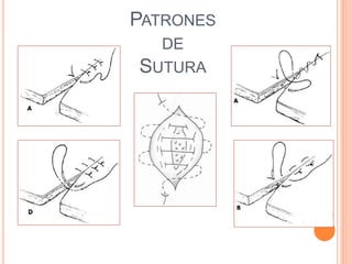 PATRONES
DE
SUTURA
 
