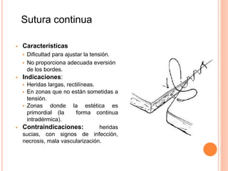  Características
 Dificultad para ajustar la tensión.
 No proporciona adecuada eversión
de los bordes.
 Indicaciones:
 Heridas largas, rectilíneas.
 En zonas que no están sometidas a
tensión.
 Zonas donde la estética es
primordial (la forma continua
intradérmica).
 Contraindicaciones: heridas
sucias, con signos de infección,
necrosis, mala vascularización.
Sutura continua
 