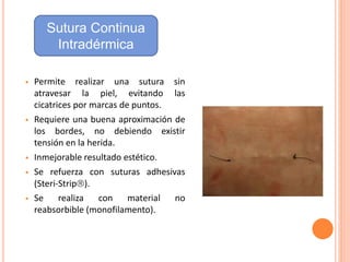  Permite realizar una sutura sin
atravesar la piel, evitando las
cicatrices por marcas de puntos.
 Requiere una buena aproximación de
los bordes, no debiendo existir
tensión en la herida.
 Inmejorable resultado estético.
 Se refuerza con suturas adhesivas
(Steri-Strip).
 Se realiza con material no
reabsorbible (monofilamento).
Sutura Continua
Intradérmica
 