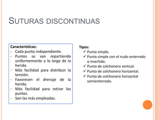 SUTURAS DISCONTINUAS
Características:
 Cada punto independiente.
 Puntos se van repartiendo
uniformemente a lo largo de la
herida.
 Más facilidad para distribuir la
tensión.
 Favorecen el drenaje de la
herida.
 Más facilidad para retirar los
puntos.
 Son las más empleadas.
Tipos:
 Punto simple.
 Punto simple con el nudo enterrado
o invertido.
 Punto de colchonero vertical.
 Punto de colchonero horizontal.
 Punto de colchonero horizontal
semienterrado.
 