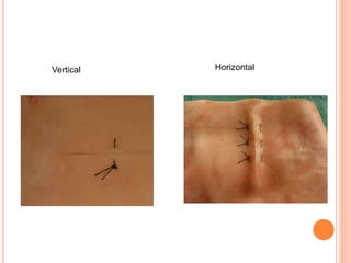 Vertical Horizontal
 