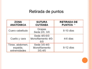 Retirada de puntos
 