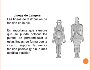 Líneas de Langers
Las líneas de distribución de
tensión en la piel.
Es importante que siempre
que se pueda colocar los
puntos en perpendicular a
estas líneas, de forma que la
cicatriz soporte la menor
tensión posible (y así lo mas
estética posible).
 