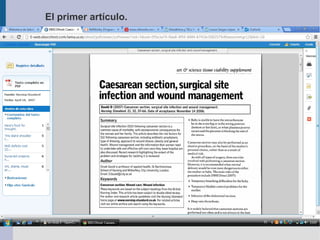 El primer artículo.
 