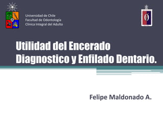 Universidad de Chile
  Facultad de Odontología
  Clínica Integral del Adulto




Utilidad del Encerado
Diagnostico y Enfilado Dentario.


                                Felipe Maldonado A.
 