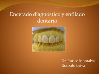 Encerado diagnóstico y enfilado
dentario
Dr. Rurico Montalva
Gonzalo Leiva
 