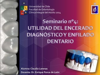 Alumna: Claudia Larenas
Docente: Dr. Enrique Ponce de León
Universidad de Chile
Facultad de Odontología
Clínica Integral del Adulto 2014
 