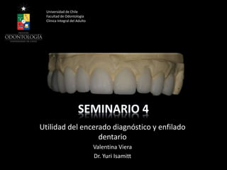 Utilidad del encerado diagnóstico y enfilado
dentario
Valentina Viera
Dr. Yuri Isamitt
Universidad de Chile
Facultad de Odontología
Clínica Integral del Adulto
 
