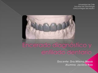 Universidad de Chile
Facultad de Odontología
Clínica Integral del Adulto I
 