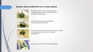 Ejemplo del procedimiento en un molar superior:
Se aplica cera a modo de base (cera
verde)para pasar a la confección de la
cúspide MV(cera gris)
Se realiza el mismo procedimiento
con las cúspides restantes
Al momento de la confección de cada cúspide
ir chequeando oclusión con modelo
antagonista
Se procede con los rebordes marginales
 