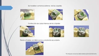 Se modelan contornos externos de las cúspides
Confección de caras internas de las cúspides
Previo a finalizar, se tallan surcos y anatomía secundaria.
*El chequeo oclusal se debe realizar permanentemente.
 