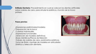 Enfilado Dentario: Procedimiento en cual se colocan los dientes artificiales
sobre rodetes de cera, para simular la estética y función de la futura
prótesis.
Pasos previos:
.Impresiones preliminares/modelos
.Preparación de la boca
.Cubetas individuales
.Impresiones funcionales
.Obtención de modelos definitivos
.Bases Metálicas/Placas de Relación
.Trabajo de rodetes de cera, parámetros estéticos.
.Toma de RMM, montaje de modelos en articulador.
.Estética y Selección dentaria.
 