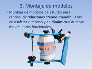 3. Montaje de modelos
• Montaje de modelos de estudio para
reproducir relaciones craneo-mandibulares
en estática o reposo y en dinámica o durante
movimientos funcionales.
 