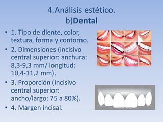 4.Análisis estético.
b)Dental
• 1. Tipo de diente, color,
textura, forma y contorno.
• 2. Dimensiones (incisivo
central superior: anchura:
8,3-9,3 mm/ longitud:
10,4-11,2 mm).
• 3. Proporción (incisivo
central superior:
ancho/largo: 75 a 80%).
• 4. Margen incisal.
 