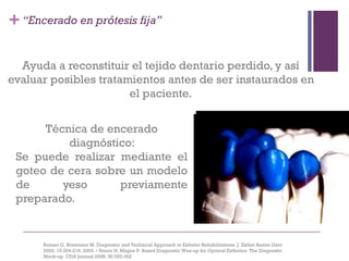 +
Romeo G, Bresciano M. Diagnostic and Technical Approach to Esthetic Rehabilitations. J. Esthet Restor Dent
2003; 15:204-216, 2003. • Simon H, Magne P. Based Diagnostic Wax-up for Optimal Esthetics: The Diagnostic
Mock-up. CDA Journal 2008; 36:355-362
La cera:
Ayuda a reconstituir el tejido dentario perdido, y así
evaluar posibles tratamientos antes de ser instaurados en
el paciente.
Técnica de encerado
diagnóstico:
Se puede realizar mediante el
goteo de cera sobre un modelo
de yeso previamente
preparado.
“Encerado en prótesis fija”
 