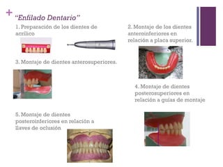 +“Enfilado Dentario”
1. Preparación de los dientes de
acrílico
2. Montaje de los dientes
anteroinferiores en
relación a placa superior.
3. Montaje de dientes anterosuperiores.
4. Montaje de dientes
posterosuperiores en
relación a guías de montaje
5. Montaje de dientes
posteroinferiores en relación a
llaves de oclusión
 