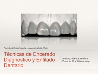 Facultad Odontología Universidad de Chile
Técnicas de Encerado
Diagnostico y Enfilado
Dentario.
Alumno: Pablo Saavedra.
Docente: Dra. Milena Moya.
 