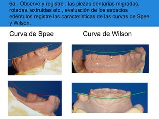 6a.- Observe y registre : las piezas dentarias migradas,
rotadas, extruidas etc., evaluación de los espacios
edéntulos registre las características de las curvas de Spee
y Wilson.
Curva de Spee Curva de Wilson
 