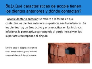 8a)¿Qué características de acople tienen
los dientes anteriores y dónde contactan?
- Acople dentario anterior: se refiere a la forma en que
contactan los dientes anteriores superiores con los inferiores. En
los dientes hay un área activa y una no activa; en los incisivos
inferiores la parte activa corresponde al borde incisal y en los
superiores corresponde al cíngulo.
En este caso el acople anterior no
se da entre todo el grupo incisivo
ya que el diente 2.8 está ausente.
 
