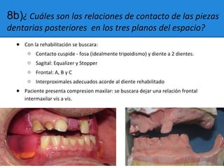 8b)¿ Cuáles son las relaciones de contacto de las piezas
dentarias posteriores en los tres planos del espacio?
● Con la rehabilitación se buscara:
o Contacto cuspide - fosa (idealmente tripoidismo) y diente a 2 dientes.
o Sagital: Equalizer y Stopper
o Frontal: A, B y C
o Interproximales adecuados acorde al diente rehabilitado
● Paciente presenta compresion maxilar: se buscara dejar una relación frontal
intermaxilar vis a vis.
 