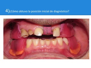 4)¿Cómo obtuvo la posición inicial de diagnóstico?
 