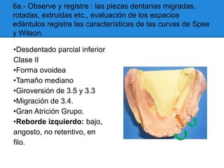 6a.- Observe y registre : las piezas dentarias migradas,
rotadas, extruidas etc., evaluación de los espacios
edéntulos registre las características de las curvas de Spee
y Wilson.
•Desdentado parcial inferior
Clase II
•Forma ovoidea
•Tamaño mediano
•Giroversión de 3.5 y 3.3
•Migración de 3.4.
•Gran Atrición Grupo.
•Reborde izquierdo: bajo,
angosto, no retentivo, en
filo.
 