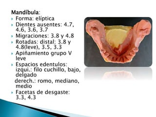 Mandíbula:
 Forma: elíptica
 Dientes ausentes: 4.7,
4.6, 3.6, 3.7
 Migraciones: 3.8 y 4.8
 Rotadas: distal: 3.8 y
4.8(leve), 3.5, 3.3
 Apiñamiento grupo V
leve
 Espacios edentulos:
izqui.: filo cuchillo, bajo,
delgado
derech.: romo, mediano,
medio
 Facetas de desgaste:
3.3, 4.3
 