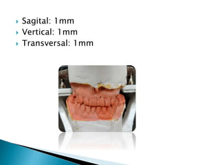  Sagital: 1mm
 Vertical: 1mm
 Transversal: 1mm
 