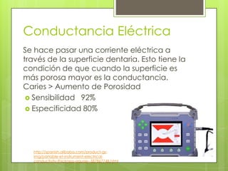 Se hace pasar una corriente eléctrica a
través de la superficie dentaria. Esto tiene la
condición de que cuando la superficie es
más porosa mayor es la conductancia.
Caries > Aumento de Porosidad
 Sensibilidad 92%
 Especificidad 80%
Conductancia Eléctrica
http://spanish.alibaba.com/product-gs-
img/portable-et-instrument-electrical-
conductivity-thickness-gauge--587867748.html
 
