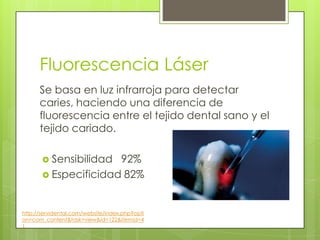Se basa en luz infrarroja para detectar
caries, haciendo una diferencia de
fluorescencia entre el tejido dental sano y el
tejido cariado.
 Sensibilidad 92%
 Especificidad 82%
Fluorescencia Láser
http://servidental.com/website/index.php?opti
on=com_content&task=view&id=122&Itemid=4
1
 