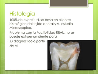 100% de exactitud, se basa en el corte
histológico del tejido dental y su estudio
Microscópico.
Problema con la Factibilidad REAL, no se
puede extraer un diente para
su diagnostico o parte
de él.
Histología
 