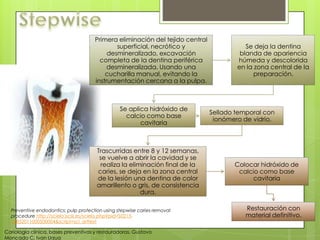 Primera eliminación del tejido central
superficial, necrótico y
desmineralizado, excavación
completa de la dentina periférica
desmineralizada. Usando una
cucharilla manual, evitando la
instrumentación cercana a la pulpa.
Se deja la dentina
blanda de apariencia
húmeda y descolorida
en la zona central de la
preparación.
Se aplica hidróxido de
calcio como base
cavitaria
Sellado temporal con
ionómero de vidrio.
Trascurridas entre 8 y 12 semanas,
se vuelve a abrir la cavidad y se
realiza la eliminación final de la
caries, se deja en la zona central
de la lesión una dentina de color
amarillento o gris, de consistencia
dura.
Colocar hidróxido de
calcio como base
cavitaria
Restauración con
material definitivo.
Cariología clínica, bases preventivas y restauradoras. Gustavo
Moncada C, Ivan Urzua
Preventive endodontics: pulp protection using stepwise caries removal
procedure http://scielo.isciii.es/scielo.php?pid=S0213-
12852011000500004&script=sci_arttext
 