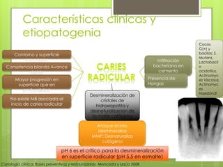 Características clínicas y
etiopatogenia
Ataque ácido;
desmineraliza
MMP: Desnaturaliza
colágeno
Cariología clínica: Bases preventivas y restauradoras. Moncada y Urzúa 2008
pH 6 es el critico para la desmineralización
en superficie radicular (pH 5.5 en esmalte)
Contorno y superficie
irregulares
Consistencia blanda Avance
rápido
Mayor progresión en
superficie que en
profundidad
No existe MB asociada al
inicio de caries radicular
Desmineralización de
cristales de
hidroxiapatita y
desnaturalizacion de
la matriz colágena
Infiltración
bacteriana en
cemento
Presencia de
Hongos
Cocos
G(+) y
bacilos; S.
Mutans,
Lactobacil
o
acidofilus,
Actinomyc
es Viscosus,
Actinomyc
es
Naeslündi
 