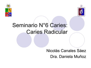 Seminario N°6 Caries:
    Caries Radicular


            Nicolás Canales Sáez
              Dra. Daniela Muñoz
 