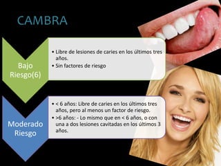CAMBRA
Bajo
Riesgo(6)
• Libre de lesiones de caries en los últimos tres
años.
• Sin factores de riesgo
Moderado
Riesgo
• < 6 años: Libre de caries en los últimos tres
años, pero al menos un factor de riesgo.
• >6 años: - Lo mismo que en < 6 años, o con
una a dos lesiones cavitadas en los últimos 3
años.
 