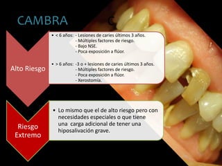 CCAMBRA
Alto Riesgo
• < 6 años: - Lesiones de caries últimos 3 años.
- Múltiples factores de riesgo.
- Bajo NSE.
- Poca exposición a flúor.
• > 6 años: -3 o + lesiones de caries últimos 3 años.
- Múltiples factores de riesgo.
- Poca exposición a flúor.
- Xerostomía.
Riesgo
Extremo
• Lo mismo que el de alto riesgo pero con
necesidades especiales o que tiene
una carga adicional de tener una
hiposalivación grave.
 