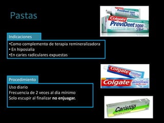Pastas
•Como complemento de terapia remineralizadora
• En hiposialia
•En caries radiculares expuestas
Uso diario
Frecuencia de 2 veces al día mínimo
Solo escupir al finalizar no enjuagar.
Indicaciones
Procedimiento
 