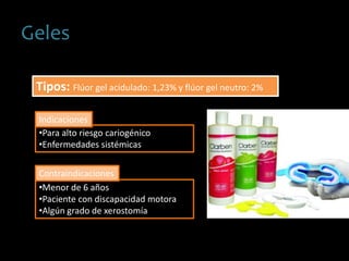 Geles
Tipos: Flúor gel acidulado: 1,23% y flúor gel neutro: 2%
•Para alto riesgo cariogénico
•Enfermedades sistémicas
•Menor de 6 años
•Paciente con discapacidad motora
•Algún grado de xerostomía
Indicaciones
Contraindicaciones
 
