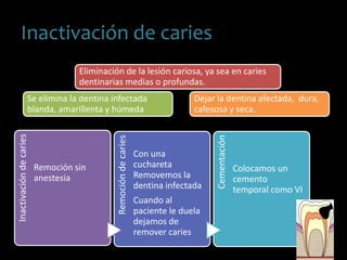 Inactivación de caries
Eliminación de la lesión cariosa, ya sea en caries
dentinarias medias o profundas.
Se elimina la dentina infectada
blanda, amarillenta y húmeda
Dejar la dentina afectada, dura,
cafesosa y seca.
Inactivacióndecaries
Remoción sin
anestesia
Remocióndecaries
Con una
cuchareta
Removemos la
dentina infectada
Cuando al
paciente le duela
dejamos de
remover caries
Cementación
Colocamos un
cemento
temporal como VI
 