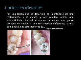 Caries recidivante
“Es una lesión que se desarrolla en la interfase de una
restauración y el diente, y nos pueden indicar una
susceptibilidad inusual al ataque de caries, una pobre
preparación cavitaria, una restauración defectuosa o una
combinación de estos factores”(1).
Figueroa-Gordon M.
 