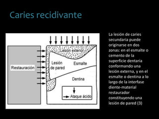 Caries recidivante
La lesión de caries
secundaria puede
originarse en dos
zonas: en el esmalte o
cemento de la
superficie dentaria
conformando una
lesión externa, y en el
esmalte o dentina a lo
largo de la interfase
diente-material
restaurador
constituyendo una
lesión de pared (3)
 