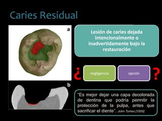 Caries Residual
Lesión de caries dejada
intencionalmente o
inadvertidamente bajo la
restauración
negligencia opción
¿ ¿
“Es mejor dejar una capa decolorada
de dentina que podría permitir la
protección de la pulpa, antes que
sacrificar el diente”. John Tomes [1859]
 
