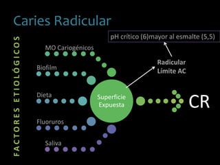 Caries RadicularFACTORESETIOLÓGICOS
Superficie
Expuesta
MO Cariogénicos
Biofilm
Dieta
Fluoruros
Saliva
CR
pH crítico (6)mayor al esmalte (5,5)
Radicular
Límite AC
 